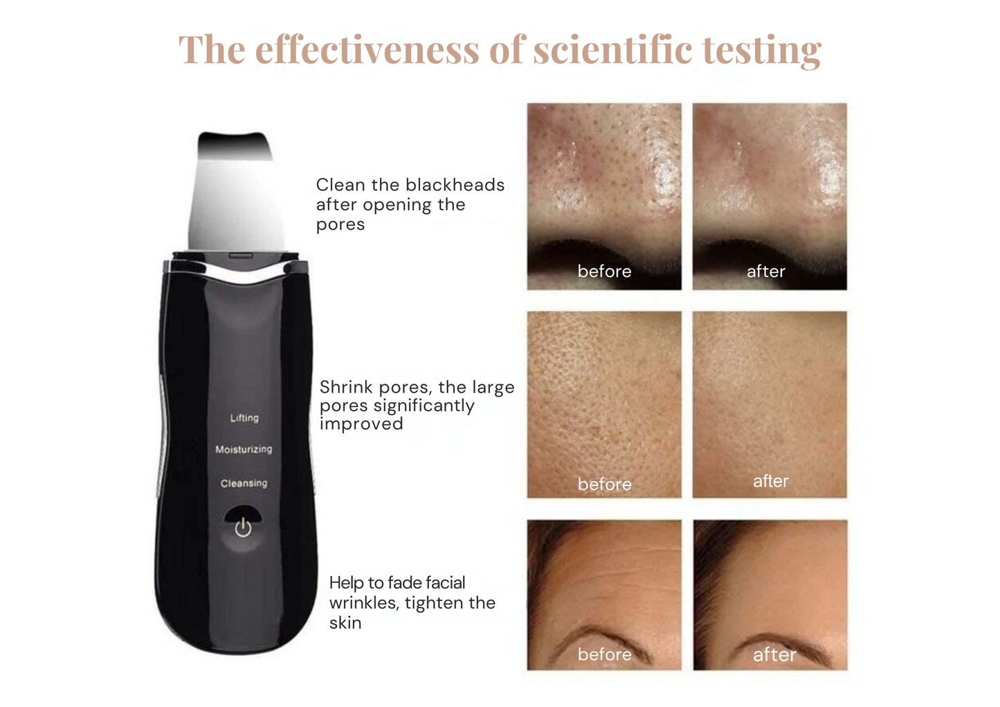 GlowLift™ Ultrasonic Skin Scrubber – Blackhead Remover & Facial Lifting Tool